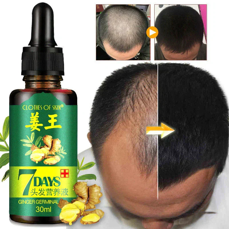 Derma Roller & Ginger Hair Oil